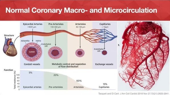 Coronárias normais: imagem de Micro e Macrocirculação